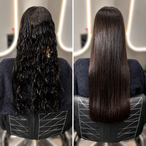 nanoplasty-before-and-after-sydney.jpg